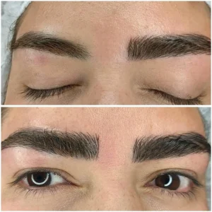 قرینه‌سازی ابرو